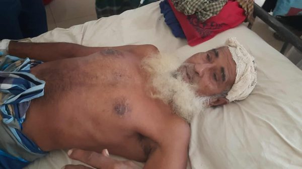 ফুলবাড়ীয়ায় পৈত্রিক জমি নিয়ে মা-রামারিতে বৃদ্ধ-কে পি-টিয়ে জ-খম